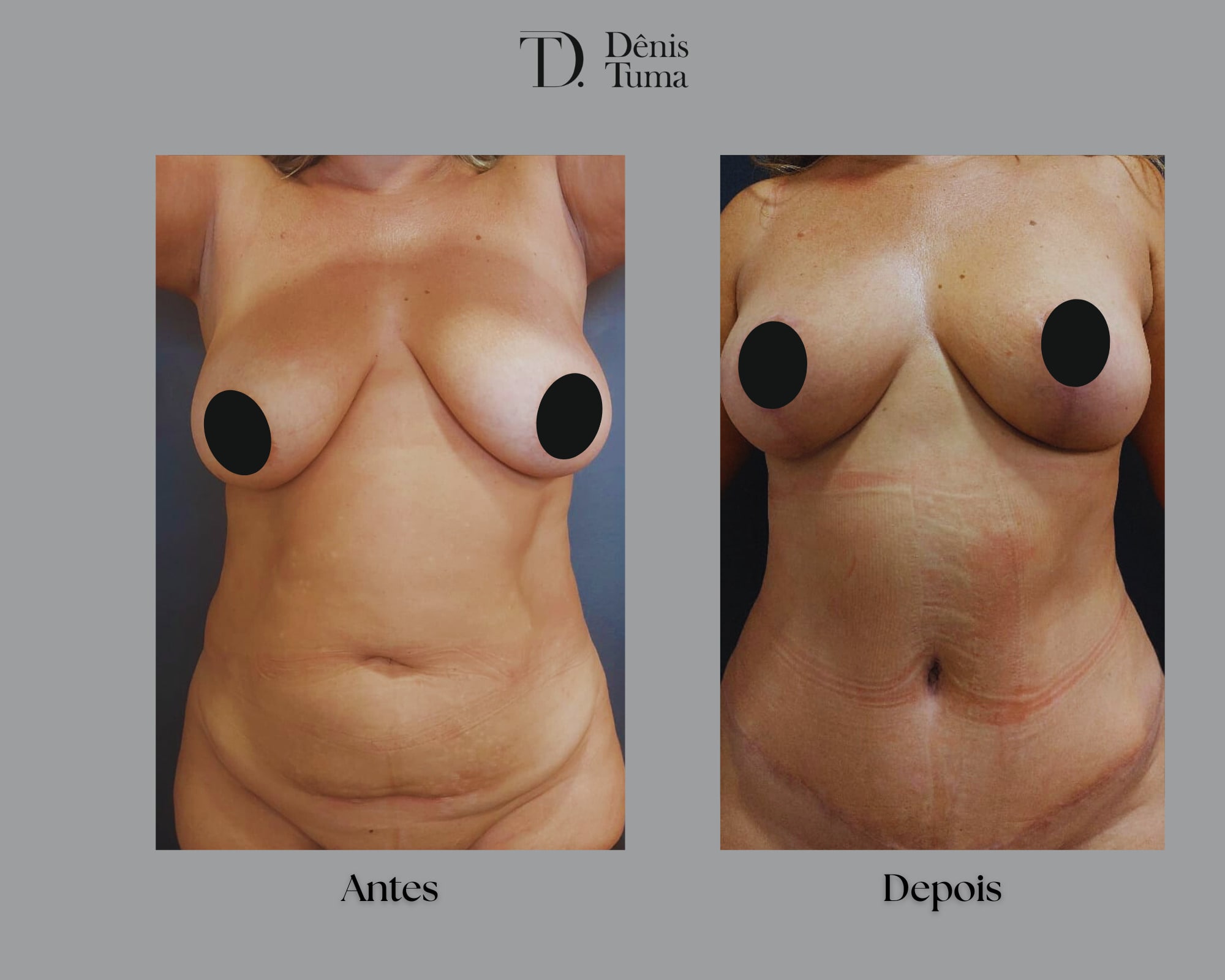 Em Branco 2 Painéis Retrato Quadrinhos-min